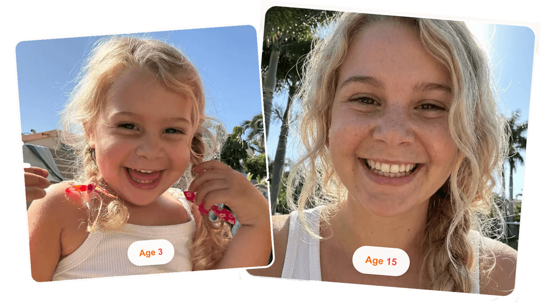 AI Age Transformation Example